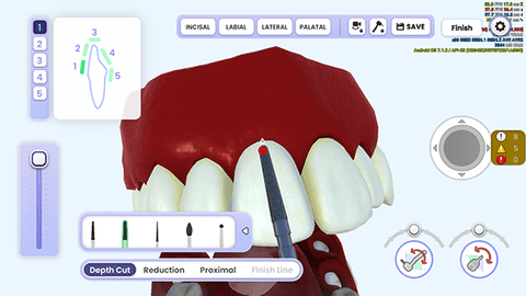 牙医模拟器(3)