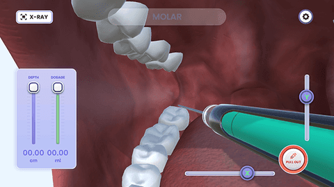 牙医模拟器(1)